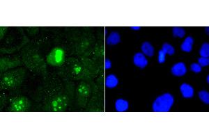Immunofluorescence analysis of A431 cells using MKI67 antibody (ABIN5997055). (Ki-67 抗体)