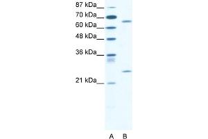 WB Suggested Anti-FOXK2 Antibody Titration:  2.