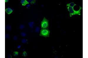 Image no. 5 for anti-Basigin (Ok Blood Group) (BSG) antibody (ABIN1498015) (CD147 抗体)