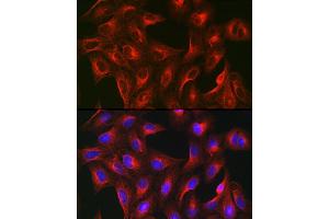 Immunofluorescence analysis of U-2 OS cells using α-Tubulin Mouse mAb (ABIN7271035) at dilution of 1:100 (40x lens). (TUBA4A 抗体)