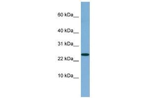 NBL1 antibody used at 1 ug/ml to detect target protein. (NBL1 抗体  (Middle Region))