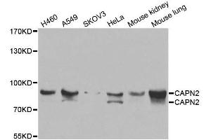 Western blot analysis of extracts of various cell lines, using CAPN2 antibody. (Calpain 2 抗体  (AA 350-680))