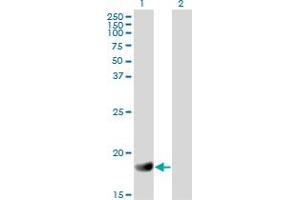 Western Blot analysis of RGS3 expression in transfected 293T cell line by RGS3 monoclonal antibody (M01), clone 1E8-C7. (RGS3 抗体  (AA 1-192))