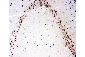 Anti-MEKK3 antibody, IHC(P) IHC(P): Rat Brain Tissue (MAP3K3 抗体  (N-Term))