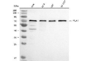 Western blot analysis of PLAT using anti-PLAT antibody (ABIN3042504).