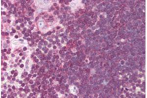 Human Thymus (formalin-fixed, paraffin-embedded) stained with ALOX5 antibody ABIN214074 at 10 ug/ml followed by biotinylated goat anti-rabbit IgG secondary antibody ABIN481713, alkaline phosphatase-streptavidin and chromogen. (ALOX5 抗体  (AA 130-149))