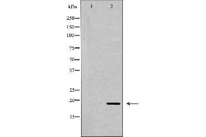 anti-DNA-Damage-Inducible Transcript 3 (DDIT3) (N-Term) antibody