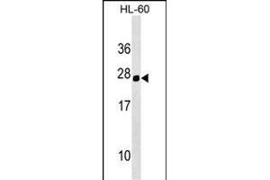 Mouse Hoxc5 Antibody (C-term) (ABIN1536714 and ABIN2849346) western blot analysis in HL-60 cell line lysates (35 μg/lane). (Homeobox C5 抗体  (C-Term))