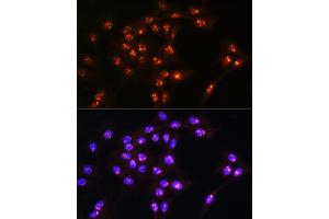Immunofluorescence (IF) image for anti-Ly1 Antibody Reactive (LYAR) (AA 10-160) antibody (ABIN7268311)
