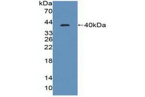 Detection of Recombinant IRF8, Human using Polyclonal Antibody to Interferon Regulatory Factor 8 (IRF8) (IRF8 抗体  (AA 128-426))