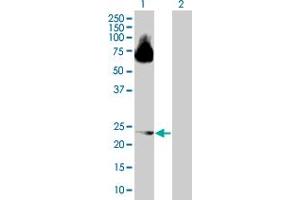 Western Blot analysis of ARL4D expression in transfected 293T cell line by ARL4D MaxPab polyclonal antibody. (ARL4D 抗体  (AA 1-201))