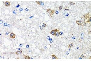 Immunohistochemistry of paraffin-embedded Rat brain using ACVR1C Polyclonal Antibody at dilution of 1:100 (40x lens).