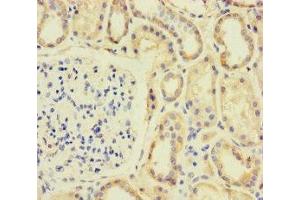 Immunohistochemistry of paraffin-embedded human kidney tissue using ABIN7170610 at dilution of 1:100 (SPIN4 抗体  (AA 1-249))