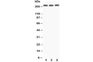 Western blot testing of NOTCH4 antibody and Lane 1:  A549;  2: SMMC-7721;  3: HeLa. (NOTCH4 抗体  (C-Term))