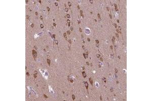 Immunohistochemical staining (Formalin-fixed paraffin-embedded sections) of human cerebral cortex with GAS7 polyclonal antibody  shows cytoplasmic positivity in neurons.