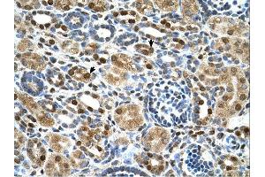 ZNF169 antibody was used for immunohistochemistry at a concentration of 4-8 ug/ml. (ZNF169 抗体  (Middle Region))