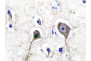 Image no. 1 for anti-S100 Calcium Binding Protein A1 (S100A1) antibody (ABIN271809) (S100A1 抗体)