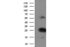 Western Blotting (WB) image for anti-Zinc Finger, AN1-Type Domain 2B (ZFAND2B) antibody (ABIN1501803)