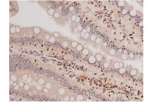 ABIN6269133 at 1/200 staining Rat intestinal tissue sections by IHC-P. (KIT 抗体  (Internal Region))