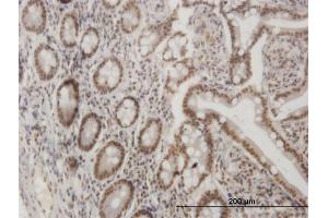 Immunoperoxidase of monoclonal antibody to LHX4 on formalin-fixed paraffin-embedded human small Intestine. (LHX4 抗体  (AA 291-390))