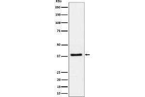 Western blot analysis of UCHL5IP expression in Jurkat cell lysate.