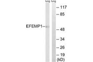 Western blot analysis of extracts from rat lung, using EFEMP1 Antibody. (FBLN3 抗体  (AA 111-160))
