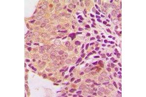 Immunohistochemistry (IHC) image for anti-Secreted Frizzled-Related Protein 4 (SFRP4) antibody (ABIN7308324) (SFRP4 抗体)