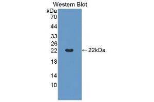Detection of Recombinant TNFRSF5, Mouse using Polyclonal Antibody to Tumor Necrosis Factor Receptor Superfamily, Member 5 (CD40) (CD40 抗体  (AA 26-193))