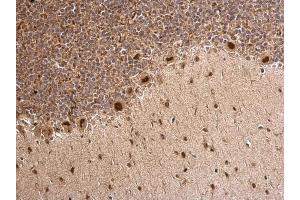 IHC-P Image MTA1 antibody [C1C3] detects MTA1 protein at nucleus on rat hind brain by immunohistochemical analysis. (MTA1 抗体)
