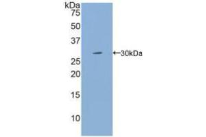 Western blot analysis of recombinant Human IL2Rg. (IL2RG 抗体  (AA 23-262))