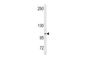 Western blot analysis of anti- in Y79 cell line lysates (35ug/lane). (ENPP2 抗体  (AA 401-430))