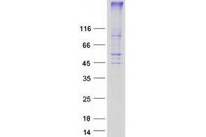 Validation with Western Blot