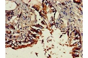 Immunohistochemistry of paraffin-embedded human lung tissue using ABIN7149671 at dilution of 1:100 (DENND1C 抗体  (AA 601-801))