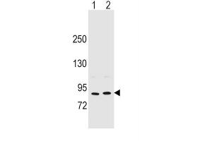 Western Blotting (WB) image for anti-Periostin (POSTN) antibody (ABIN2996464) (Periostin 抗体)