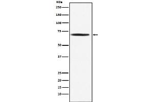 Western blot analysis of DLAT expression in Jurkat cell lysate. (Recombinant DLAT 抗体)