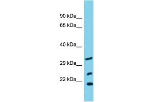 Host: Rabbit Target Name: SLC25A17 Sample Type: OVCAR-3 Whole Cell lysates Antibody Dilution: 1. (SLC25A17 抗体  (N-Term))