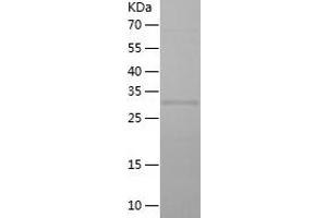 ELL2 Protein (AA 350-572) (His tag)