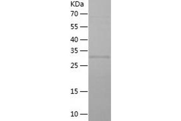 ELL2 Protein (AA 350-572) (His tag)