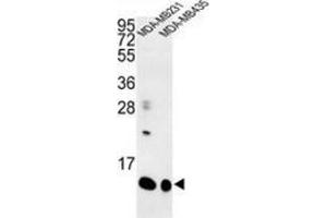 Western blot analysis of Cornifin-B (arrow) in MDA-MB231, MDA-MB435 cell line lysates (35ug/lane) using SPRR1B / Cornifin-B Antibody (C-term). (SPRR1B 抗体  (C-Term))