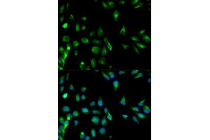 Immunofluorescence analysis of HeLa cells using RASSF1 antibody. (RASSF1 抗体)