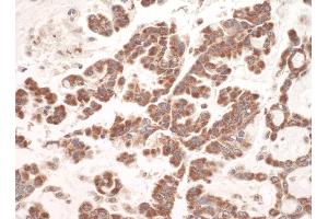 Immunohistochemistry (IHC) image for anti-Complement Component 1, Q Subcomponent Binding Protein (C1QBP) (AA 150-200) antibody (ABIN7454879)