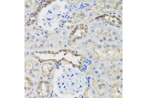 Immunohistochemistry of paraffin-embedded rat kidney using B9D1 antibody. (B9D1 抗体)