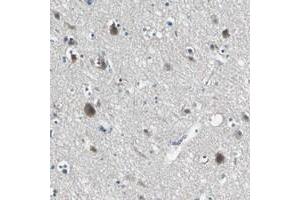 Immunohistochemical staining of human cerebral cortex with SLC16A7 polyclonal antibody  shows moderate cytoplasmic positivity in neuronal cells. (SLC16A7 抗体)
