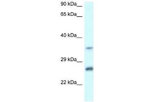 Western Blot showing CBR4 antibody used at a concentration of 1 ug/ml against Jurkat Cell Lysate (CBR4 抗体  (C-Term))