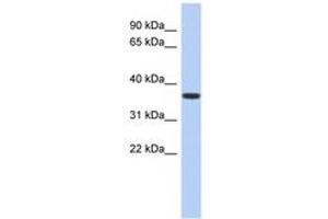 Image no. 1 for anti-Mevalonate Kinase (MVK) (AA 107-156) antibody (ABIN6743974) (MVK 抗体  (AA 107-156))