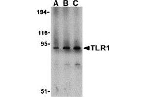 Western Blotting (WB) image for anti-Toll-Like Receptor 1 (TLR1) (N-Term) antibody (ABIN1031619) (TLR1 抗体  (N-Term))