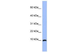 WB Suggested Anti-ACBD7 Antibody Titration: 0. (ACBD7 抗体  (N-Term))