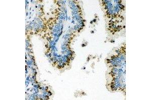 Immunohistochemical analysis of Unc18-2 staining in human prostate formalin fixed paraffin embedded tissue section. (STXBP2 抗体)
