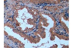 Immunohistochemistry (IHC) image for anti-Tubulin, beta (TUBB) (AA 170-419) antibody (ABIN7428434)