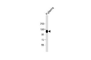 Anti-ITIH4 Antibody (C-Term) at 1:2000 dilution + human plasma lysate Lysates/proteins at 20 μg per lane. (ITIH4 抗体  (AA 885-917))
